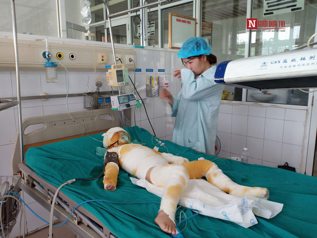 Vụ cô giáo đốt cồn dạy phòng chống cháy nổ: Nghẹn ngào lời kể của người mẹ trẻ - 1 Vụ cô giáo đốt cồn dạy phòng chống cháy nổ: Nghẹn ngào lời kể của người mẹ trẻ - 1