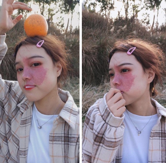 Cô gái có vết chàm lớn trên mặt trở thành mẫu lookbook nổi tiếng: Điều quan trọng là phải tự tin vào chính mình - 1 Cô gái có vết chàm lớn trên mặt trở thành mẫu lookbook nổi tiếng: Điều quan trọng là phải tự tin vào chính mình - 1