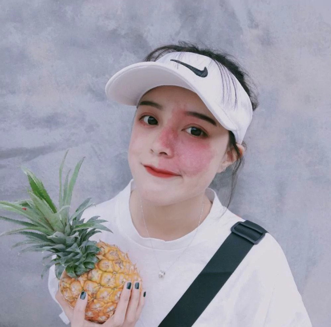 Cô gái có vết chàm lớn trên mặt trở thành mẫu lookbook nổi tiếng: Điều quan trọng là phải tự tin vào chính mình - 8 Cô gái có vết chàm lớn trên mặt trở thành mẫu lookbook nổi tiếng: Điều quan trọng là phải tự tin vào chính mình - 8
