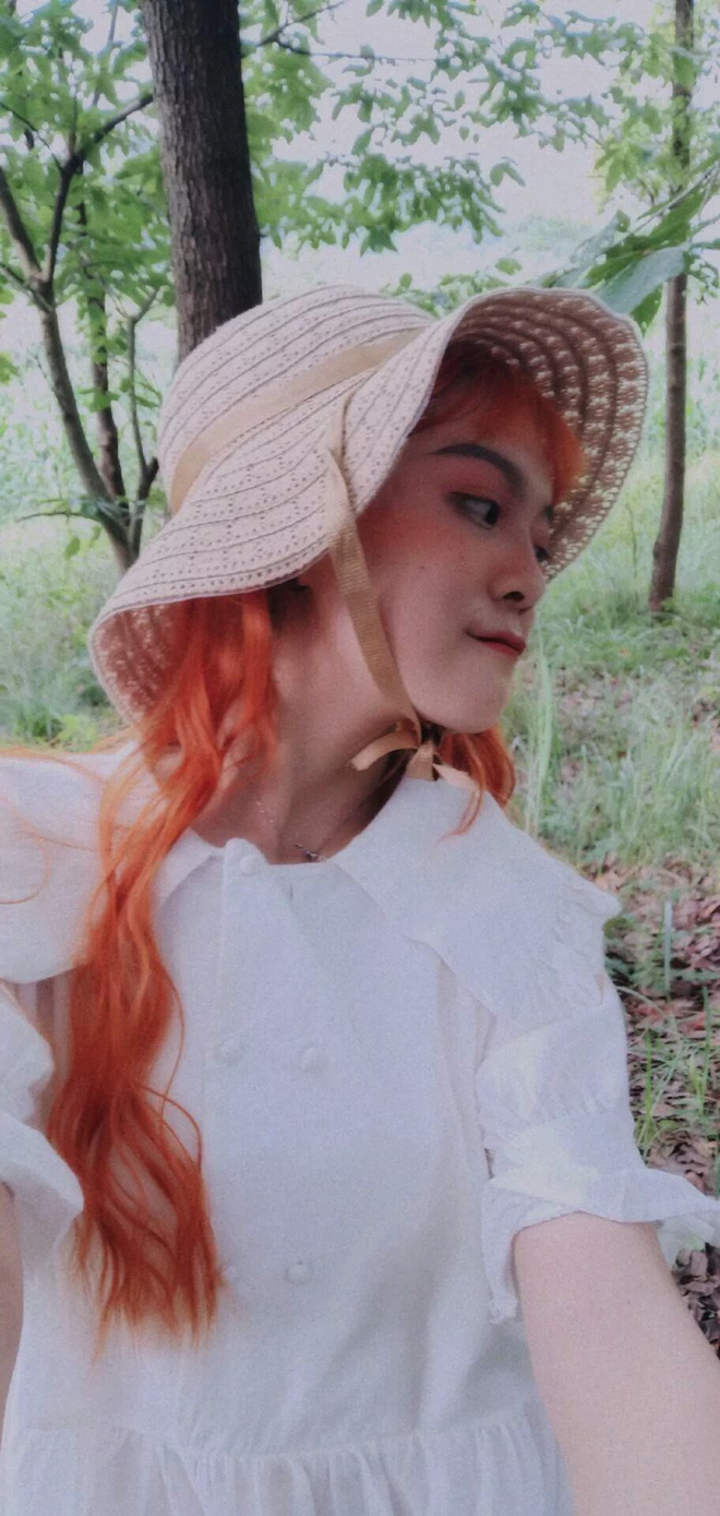 Cô gái có vết chàm lớn trên mặt trở thành mẫu lookbook nổi tiếng: Điều quan trọng là phải tự tin vào chính mình - 6 Cô gái có vết chàm lớn trên mặt trở thành mẫu lookbook nổi tiếng: Điều quan trọng là phải tự tin vào chính mình - 6