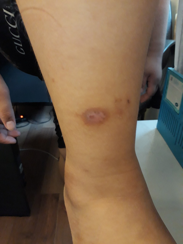 Nghi án bố cùng dì ghẻ bạo hành con trai dã man suốt nhiều năm ở Phú Thọ: Đốt túi bóng nhỏ vào mông, bắt nhặt cơm dưới đất lên ăn - 3 Nghi án bố cùng dì ghẻ bạo hành con trai dã man suốt nhiều năm ở Phú Thọ: Đốt túi bóng nhỏ vào mông, bắt nhặt cơm dưới đất lên ăn - 3