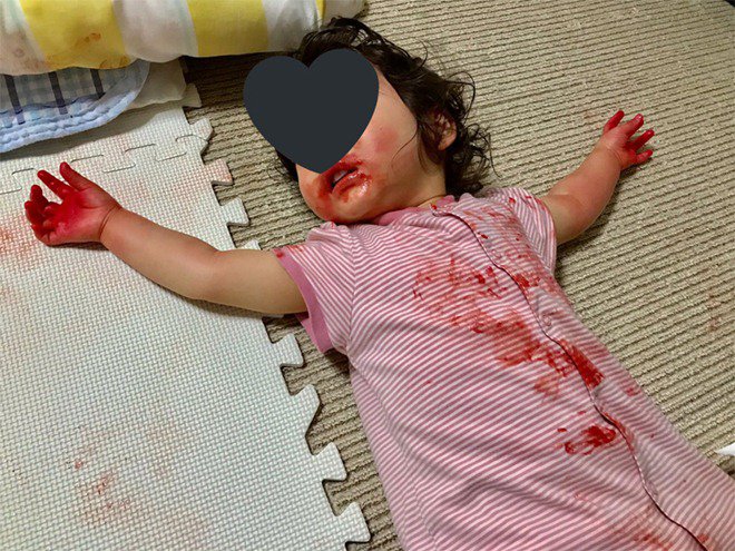 Vắng mặt ít phút, mẹ suýt ngất khi thấy con gái nằm im, khắp người toàn màu đỏ Vắng mặt ít phút, mẹ suýt ngất khi thấy con gái nằm im, khắp người toàn màu đỏ