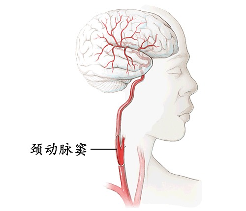 Đang tân hôn cao trào, cô dâu bỗng ngã khụy rồi tử vong vì chú rể hôn trúng 'chỗ phạm' nguy hiểm này Đang tân hôn cao trào, cô dâu bỗng ngã khụy rồi tử vong vì chú rể hôn trúng 'chỗ phạm' nguy hiểm này