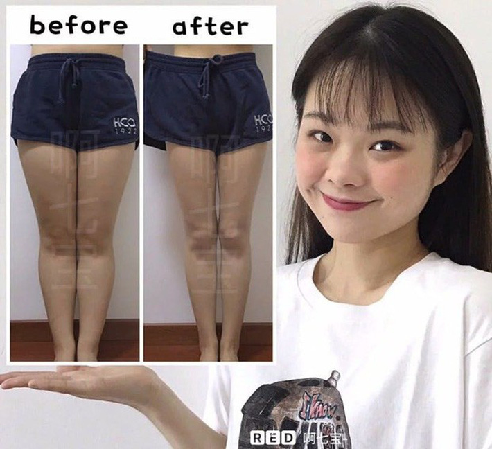 Giảm 23kg sau 1 năm kiên trì, cô gái này có bí quyết gì mà lột xác ngoạn mục đến vậy? - 5 Giảm 23kg sau 1 năm kiên trì, cô gái này có bí quyết gì mà lột xác ngoạn mục đến vậy? - 5