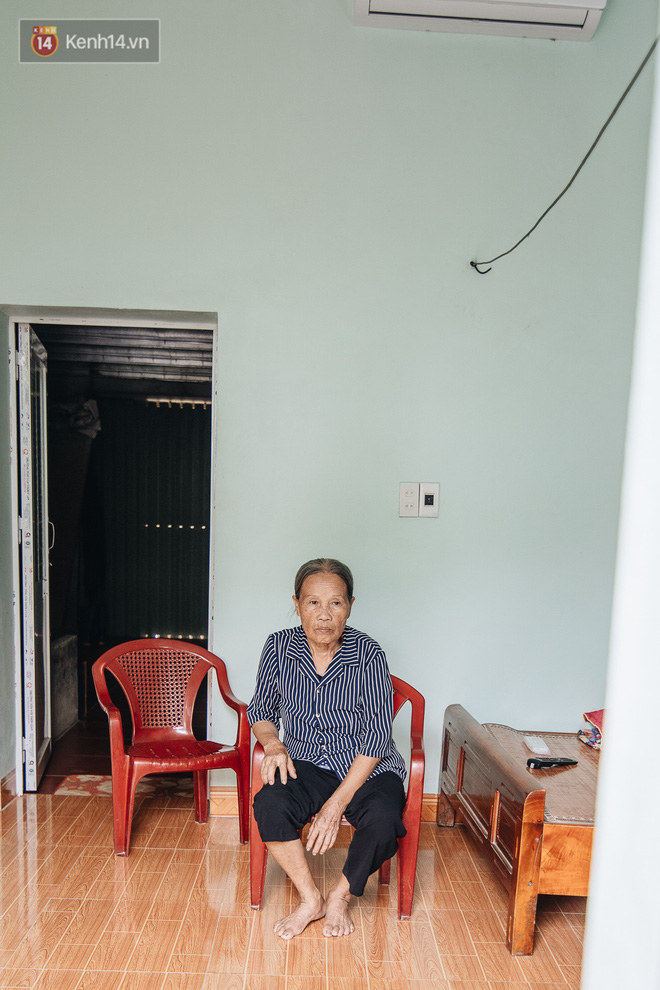 Số phận cay đắng của 'người cây' kì lạ nhất Việt Nam: Mẹ cõng con đi điều trị gần 50 năm, phải uống thuốc ngủ để quên cơn đau - 7 Số phận cay đắng của 'người cây' kì lạ nhất Việt Nam: Mẹ cõng con đi điều trị gần 50 năm, phải uống thuốc ngủ để quên cơn đau - 7