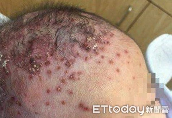 'Tranh thủ' với gái lạ, người cha mắc 4 bệnh tình dục khiến con nhỏ cũng phải chịu hậu quả - 1 'Tranh thủ' với gái lạ, người cha mắc 4 bệnh tình dục khiến con nhỏ cũng phải chịu hậu quả - 1