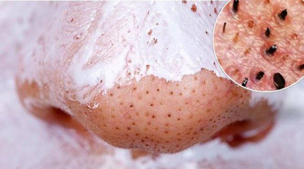 Biết hết những công dụng này của kem đánh răng, bạn sẽ tiết kiệm hàng chục triệu tiền mỹ phẩm Biết hết những công dụng này của kem đánh răng, bạn sẽ tiết kiệm hàng chục triệu tiền mỹ phẩm