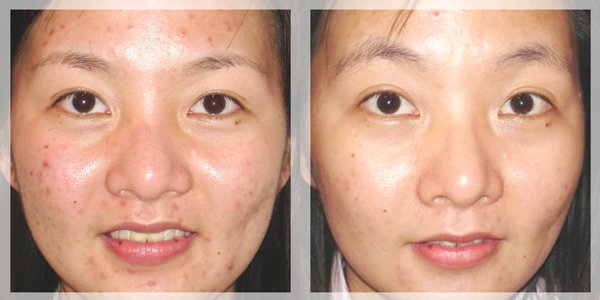 Biết hết những công dụng này của kem đánh răng, bạn sẽ tiết kiệm hàng chục triệu tiền mỹ phẩm - 1 Biết hết những công dụng này của kem đánh răng, bạn sẽ tiết kiệm hàng chục triệu tiền mỹ phẩm - 1