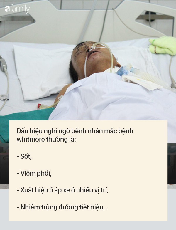Dấu hiệu bệnh whitmore - căn bệnh do vi khuẩn ăn mòn cơ thể con người, có thể gây tử vong trong vài ngày - 1 Dấu hiệu bệnh whitmore - căn bệnh do vi khuẩn ăn mòn cơ thể con người, có thể gây tử vong trong vài ngày - 1