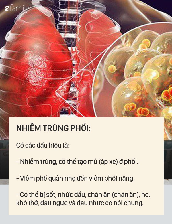 Dấu hiệu bệnh whitmore - căn bệnh do vi khuẩn ăn mòn cơ thể con người, có thể gây tử vong trong vài ngày - 2 Dấu hiệu bệnh whitmore - căn bệnh do vi khuẩn ăn mòn cơ thể con người, có thể gây tử vong trong vài ngày - 2