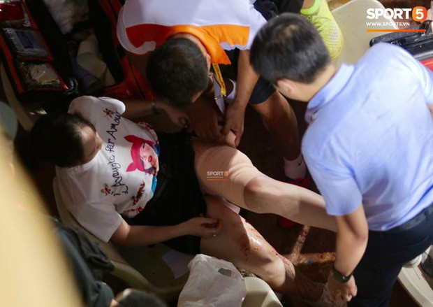 Trước vụ nữ CĐV bị bỏng do pháo sáng, thế giới từng chứng kiến thảm kịch tồi tệ do đám đông 'hooligan' gây ra trên khán đài khiến 39 người chết Trước vụ nữ CĐV bị bỏng do pháo sáng, thế giới từng chứng kiến thảm kịch tồi tệ do đám đông 'hooligan' gây ra trên khán đài khiến 39 người chết