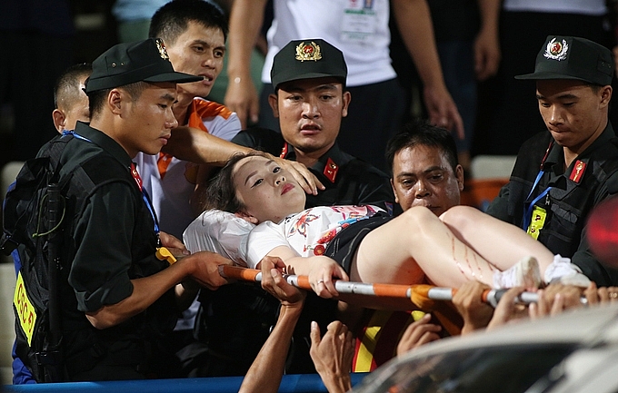 CĐV nữ bị bỏng lưu huỳnh vào tận xương do pháo sáng, phải phẫu thuật 2 lần CĐV nữ bị bỏng lưu huỳnh vào tận xương do pháo sáng, phải phẫu thuật 2 lần