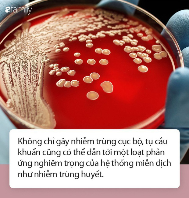 Dấu hiệu nhiễm trùng tụ cầu khuẩn bất kì ai cũng không được bỏ qua Dấu hiệu nhiễm trùng tụ cầu khuẩn bất kì ai cũng không được bỏ qua