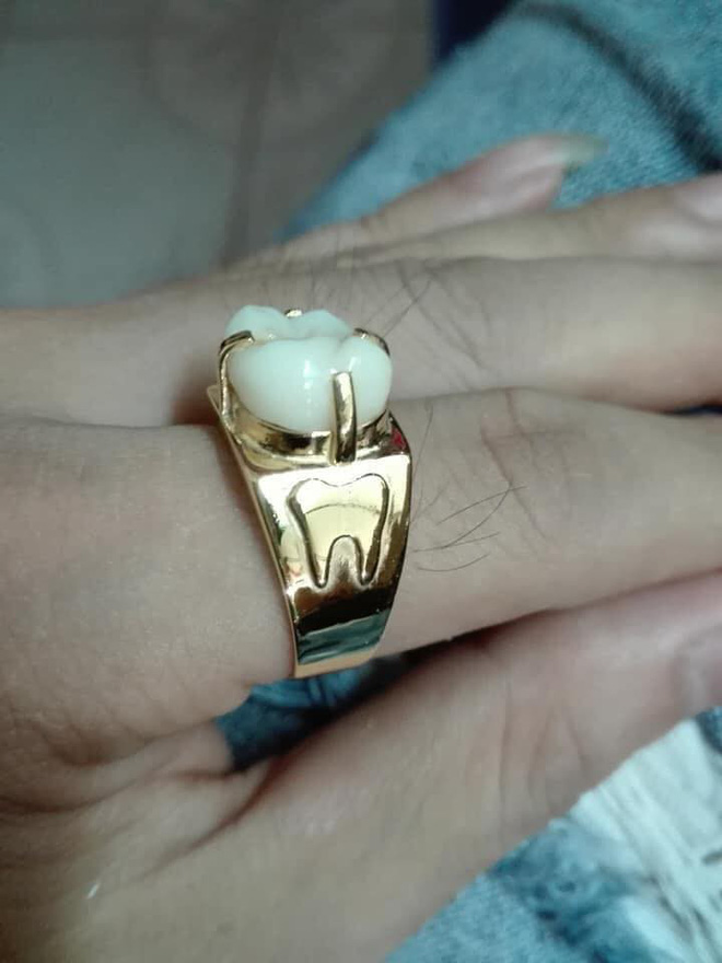 Người phụ nữ mang chiếc răng đi làm mặt nhẫn, câu chuyện đằng sau khiến nhiều người 'xanh mắt' - 1 Người phụ nữ mang chiếc răng đi làm mặt nhẫn, câu chuyện đằng sau khiến nhiều người 'xanh mắt' - 1