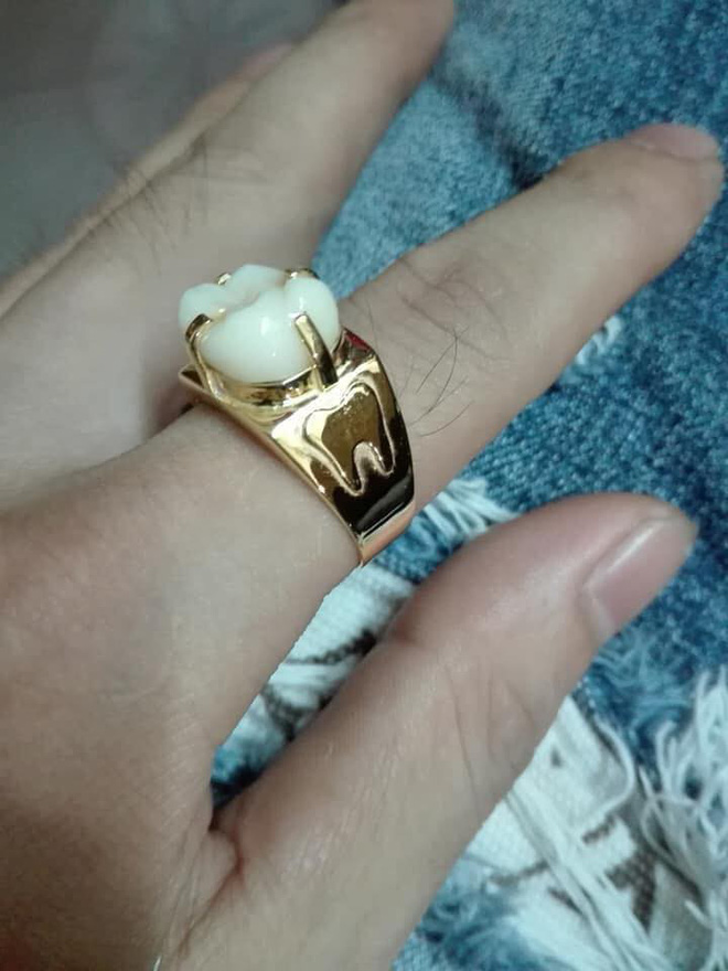Người phụ nữ mang chiếc răng đi làm mặt nhẫn, câu chuyện đằng sau khiến nhiều người 'xanh mắt' - 2 Người phụ nữ mang chiếc răng đi làm mặt nhẫn, câu chuyện đằng sau khiến nhiều người 'xanh mắt' - 2