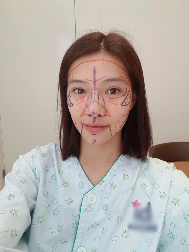 Xem này, chẳng mấy ai nhận ra Lưu Đê Ly và hội bạn xuyên quốc gia sau khi 'đập mặt xây lại' - 8 Xem này, chẳng mấy ai nhận ra Lưu Đê Ly và hội bạn xuyên quốc gia sau khi 'đập mặt xây lại' - 8