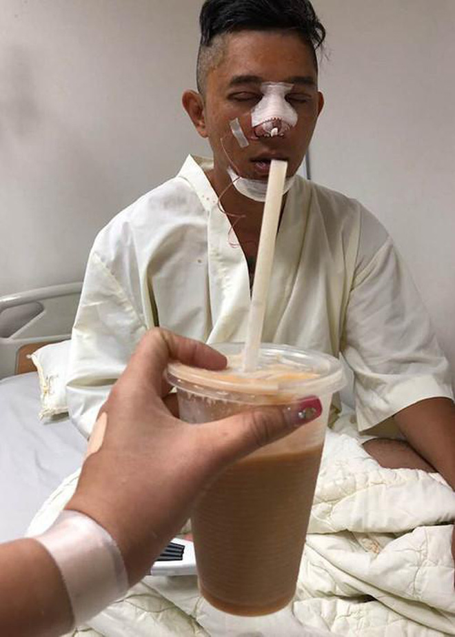 Nhìn lại nhan sắc hiện tại của Lương Bằng Quang sau ca 'đập mặt xây lại' hơn 100 triệu, kéo dài hơn 24 giờ: Thành công hay thất bại? - 6 Nhìn lại nhan sắc hiện tại của Lương Bằng Quang sau ca 'đập mặt xây lại' hơn 100 triệu, kéo dài hơn 24 giờ: Thành công hay thất bại? - 6