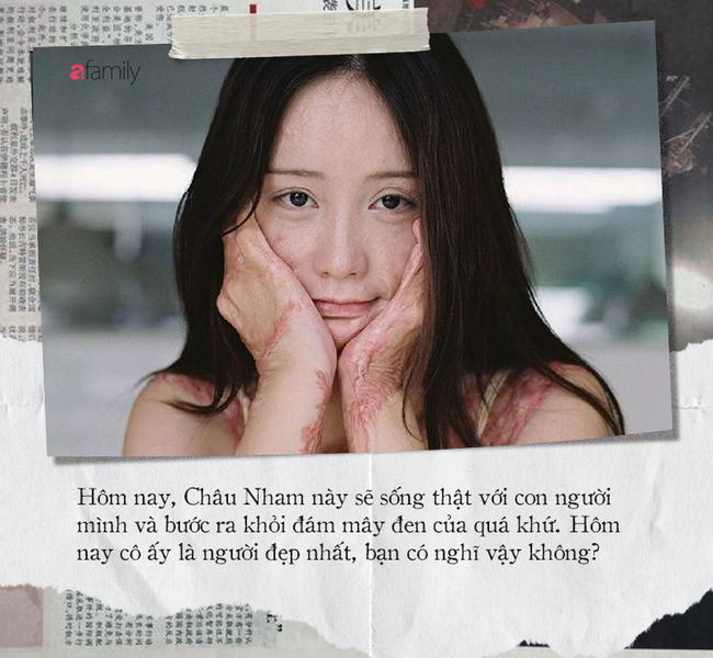 'Cả gan' cự tuyệt tình cảm của đại thiếu gia, nữ sinh xinh đẹp bị thiêu sống, hủy hoại cuộc đời, hung thủ lãnh án nhẹ nhàng nhờ gia thế khủng - 10 'Cả gan' cự tuyệt tình cảm của đại thiếu gia, nữ sinh xinh đẹp bị thiêu sống, hủy hoại cuộc đời, hung thủ lãnh án nhẹ nhàng nhờ gia thế khủng - 10