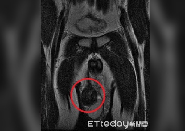 Phát hiện bạn trai có tới 3 tinh hoàn trong lúc âu yếm, cô gái ngã ngửa khi biết sự thật - 1 Phát hiện bạn trai có tới 3 tinh hoàn trong lúc âu yếm, cô gái ngã ngửa khi biết sự thật - 1