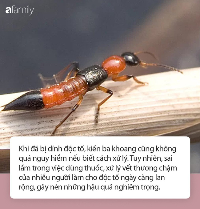 Có vết thương và bị dính độc kiến ba khoang thì nên bôi thuốc gì cho đỡ đau rát và nhanh khỏi nhất? Có vết thương và bị dính độc kiến ba khoang thì nên bôi thuốc gì cho đỡ đau rát và nhanh khỏi nhất?