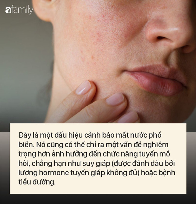8 dấu hiệu cảnh báo bệnh được 'khắc' rất rõ trên khuôn mặt của bạn 8 dấu hiệu cảnh báo bệnh được 'khắc' rất rõ trên khuôn mặt của bạn