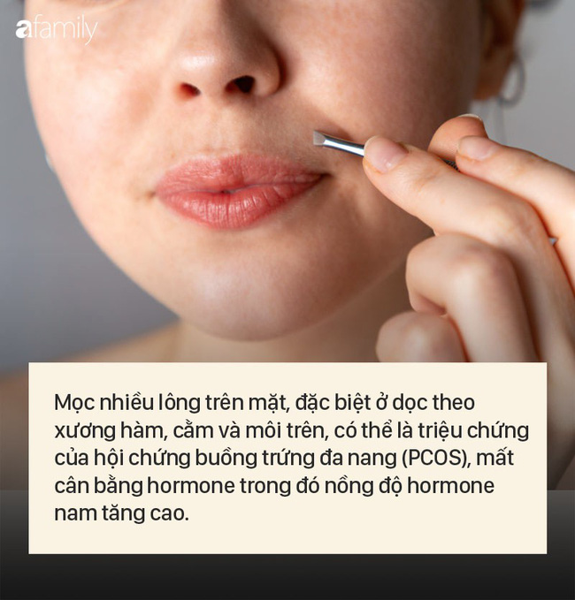 8 dấu hiệu cảnh báo bệnh được 'khắc' rất rõ trên khuôn mặt của bạn - 1 8 dấu hiệu cảnh báo bệnh được 'khắc' rất rõ trên khuôn mặt của bạn - 1