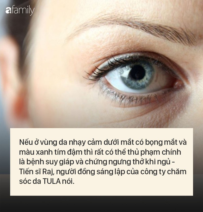 8 dấu hiệu cảnh báo bệnh được 'khắc' rất rõ trên khuôn mặt của bạn - 3 8 dấu hiệu cảnh báo bệnh được 'khắc' rất rõ trên khuôn mặt của bạn - 3