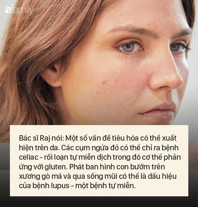 8 dấu hiệu cảnh báo bệnh được 'khắc' rất rõ trên khuôn mặt của bạn - 6 8 dấu hiệu cảnh báo bệnh được 'khắc' rất rõ trên khuôn mặt của bạn - 6