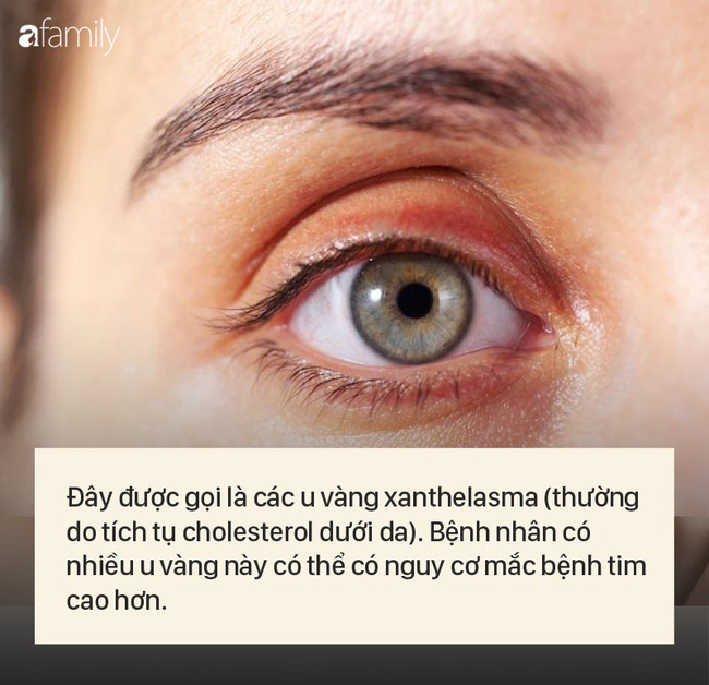 8 dấu hiệu cảnh báo bệnh được 'khắc' rất rõ trên khuôn mặt của bạn - 2 8 dấu hiệu cảnh báo bệnh được 'khắc' rất rõ trên khuôn mặt của bạn - 2