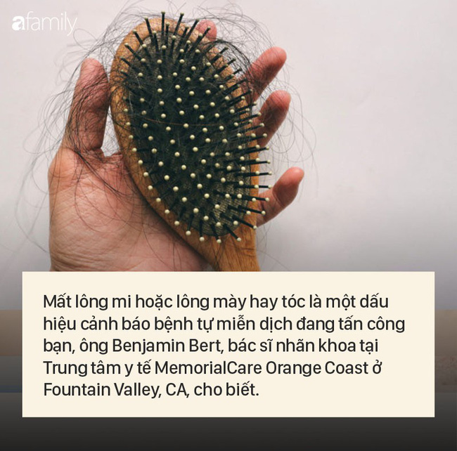 8 dấu hiệu cảnh báo bệnh được 'khắc' rất rõ trên khuôn mặt của bạn - 7 8 dấu hiệu cảnh báo bệnh được 'khắc' rất rõ trên khuôn mặt của bạn - 7