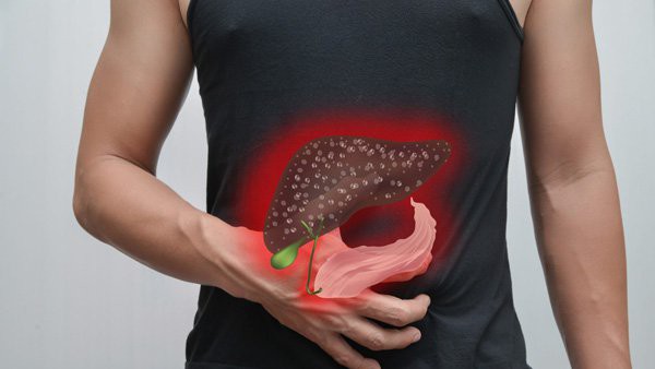 3 loại 'ung thư cặp đôi' nguy hiểm: Nếu vợ hoặc chồng đang mắc thì người kia buộc phải khám càng sớm càng tốt - 2 3 loại 'ung thư cặp đôi' nguy hiểm: Nếu vợ hoặc chồng đang mắc thì người kia buộc phải khám càng sớm càng tốt - 2