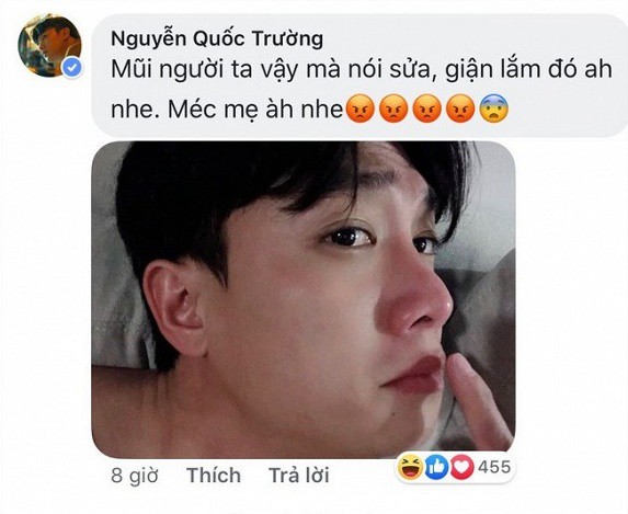 Sau Việt Anh, Quốc Trường vướng nghi án phẫu thuật thẩm mỹ mũi và đây là câu trả lời không ngờ của nam diễn viên - 3 Sau Việt Anh, Quốc Trường vướng nghi án phẫu thuật thẩm mỹ mũi và đây là câu trả lời không ngờ của nam diễn viên - 3