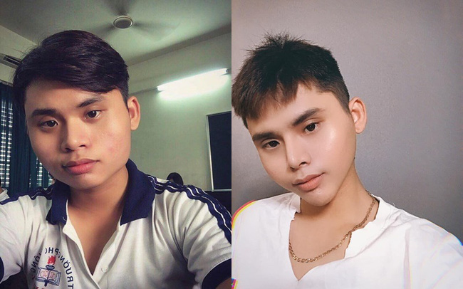 Hành trình lột xác ngoạn mục của chàng trai chi 200 triệu cho 5 lần 'dao kéo', nhiều lần phải đấu tranh '1 là đẹp hơn, 2 là chết' - 8 Hành trình lột xác ngoạn mục của chàng trai chi 200 triệu cho 5 lần 'dao kéo', nhiều lần phải đấu tranh '1 là đẹp hơn, 2 là chết' - 8