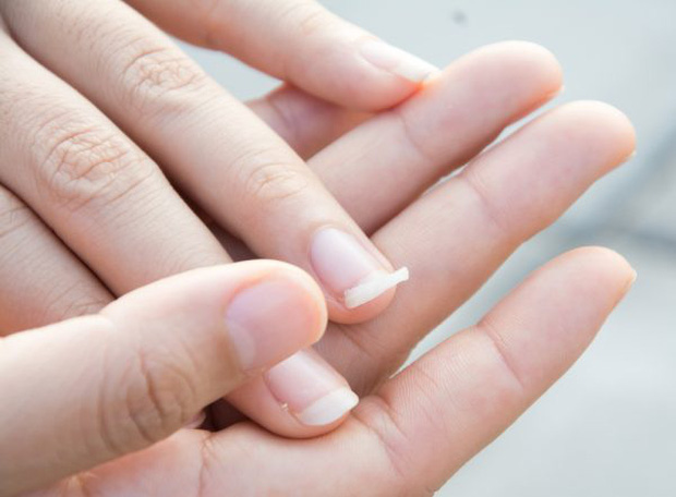 10 biểu hiện bất thường trên tay đang ngầm 'tố cáo' hàng loạt vấn đề sức khỏe mà bạn không ngờ đến - 6 10 biểu hiện bất thường trên tay đang ngầm 'tố cáo' hàng loạt vấn đề sức khỏe mà bạn không ngờ đến - 6