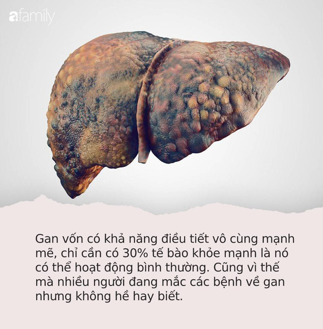 Hãy để ý: Nếu có dấu hiệu '3 đen 2 hôi' trên cơ thể thì có thể bạn đã mắc các bệnh về gan cần đi khám gấp Hãy để ý: Nếu có dấu hiệu '3 đen 2 hôi' trên cơ thể thì có thể bạn đã mắc các bệnh về gan cần đi khám gấp