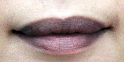 Hãy để ý: Nếu có dấu hiệu '3 đen 2 hôi' trên cơ thể thì có thể bạn đã mắc các bệnh về gan cần đi khám gấp - 1 Hãy để ý: Nếu có dấu hiệu '3 đen 2 hôi' trên cơ thể thì có thể bạn đã mắc các bệnh về gan cần đi khám gấp - 1