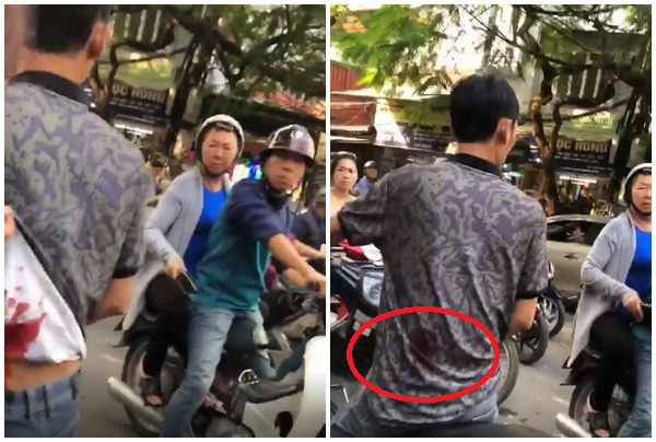 Can ẩu đả, người đàn ông bị thanh niên mặc áo Grab đâm trúng lưng - 2 Can ẩu đả, người đàn ông bị thanh niên mặc áo Grab đâm trúng lưng - 2