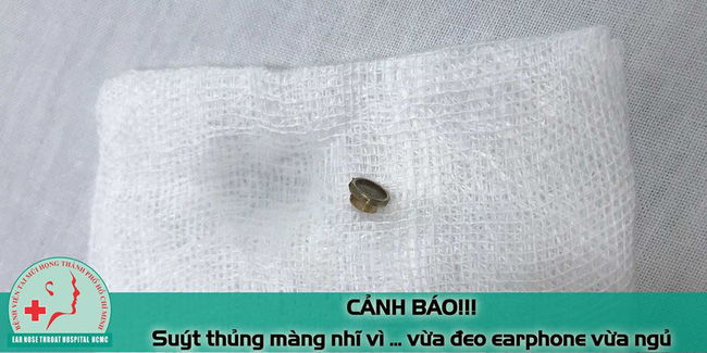 Hy hữu: Bệnh nhân nam suýt thủng màng nhĩ vì đeo tai nghe nghe nhạc khi ngủ Hy hữu: Bệnh nhân nam suýt thủng màng nhĩ vì đeo tai nghe nghe nhạc khi ngủ