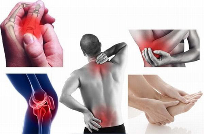 Người mắc bệnh xương khớp thường khổ sở khi trời lạnh: Hãy nghe chuyên gia chỉ cách chăm sóc cơ thể để giảm đau - 1 Người mắc bệnh xương khớp thường khổ sở khi trời lạnh: Hãy nghe chuyên gia chỉ cách chăm sóc cơ thể để giảm đau - 1