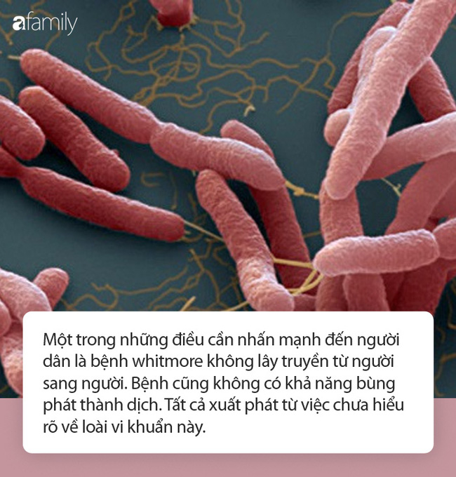 Giới chuyên gia khẳng định: Whitmore không lây truyền từ người sang người như nhiều người đang bàn tán - 1 Giới chuyên gia khẳng định: Whitmore không lây truyền từ người sang người như nhiều người đang bàn tán - 1