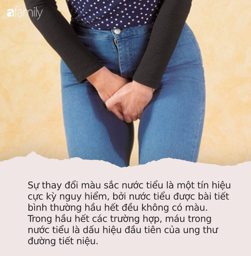 Đang chứa mầm bệnh ung thư cơ thể sẽ phát ra 4 tín hiệu nhỏ này khi đi tiểu nhưng nhiều người lại thường bỏ qua Đang chứa mầm bệnh ung thư cơ thể sẽ phát ra 4 tín hiệu nhỏ này khi đi tiểu nhưng nhiều người lại thường bỏ qua