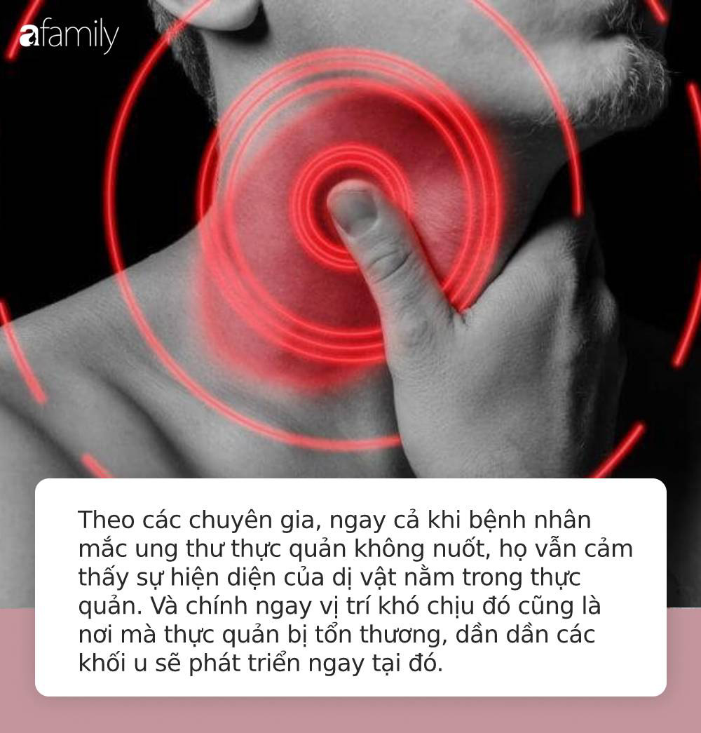 Thấy 6 dấu hiệu lạ này ở cổ họng, bạn phải tới bác sĩ ngay bởi có thể đã mắc ung thư thực quản - 2 Thấy 6 dấu hiệu lạ này ở cổ họng, bạn phải tới bác sĩ ngay bởi có thể đã mắc ung thư thực quản - 2