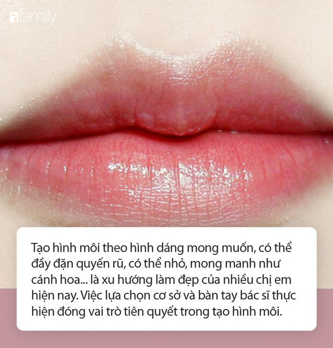 Tạo hình môi: Chuyên gia 'bật mí' những phương pháp thẩm mỹ hot nhất hiện nay Tạo hình môi: Chuyên gia 'bật mí' những phương pháp thẩm mỹ hot nhất hiện nay