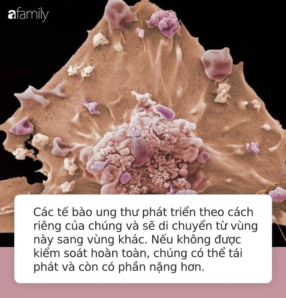 Dù đã được điều trị, tế bào ung thư vẫn có thể phát triển rầm rộ trở lại vì 3 lý do này - 2 Dù đã được điều trị, tế bào ung thư vẫn có thể phát triển rầm rộ trở lại vì 3 lý do này - 2