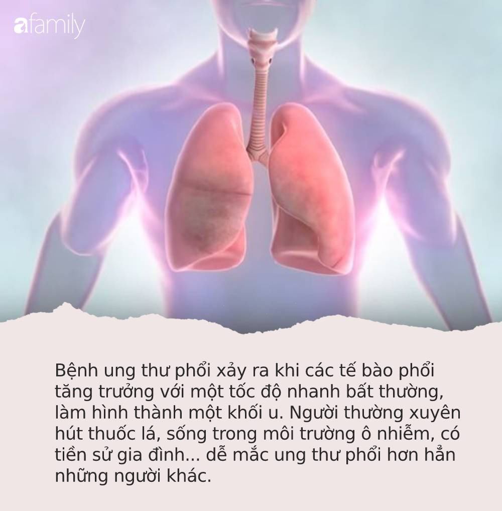 Tế bào ung thư phổi thường bị 'kích thích' khi gặp 4 kiểu người này: Nếu có tên, bạn cũng nên đi khám sớm Tế bào ung thư phổi thường bị 'kích thích' khi gặp 4 kiểu người này: Nếu có tên, bạn cũng nên đi khám sớm