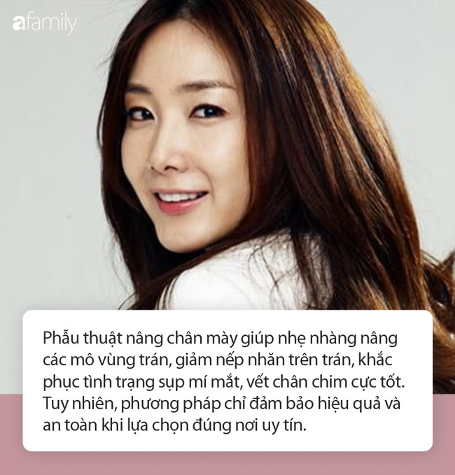 Những hình ảnh rạch da đầu bóc mỡ nâng chân mày, nâng mí sụp, tiêm filler nâng mũi cùng lúc khiến nhiều người kinh hãi - 4 Những hình ảnh rạch da đầu bóc mỡ nâng chân mày, nâng mí sụp, tiêm filler nâng mũi cùng lúc khiến nhiều người kinh hãi - 4