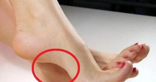 Ngó bàn chân vài giây, biết ngay dấu hiệu 'đại tài' dự báo sắp giàu to, cứ đi một bước là tiền kéo về Ngó bàn chân vài giây, biết ngay dấu hiệu 'đại tài' dự báo sắp giàu to, cứ đi một bước là tiền kéo về
