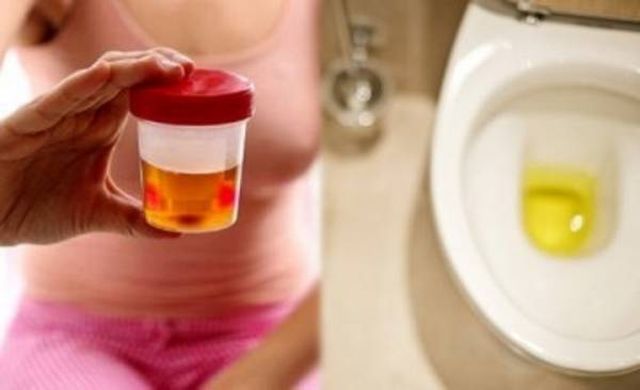 3 bộ phận trên cơ thể 'bốc mùi', chứng tỏ gan đang kêu cứu, cần phải kiểm tra kịp thời - 3 3 bộ phận trên cơ thể 'bốc mùi', chứng tỏ gan đang kêu cứu, cần phải kiểm tra kịp thời - 3