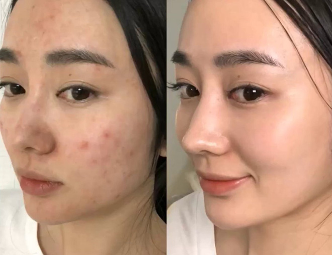 5 lọ serum Hàn giúp da căng bóng mướt mượt đón Tết sang: Nhiều loại giá mềm ai 'múc' cũng được - 7 5 lọ serum Hàn giúp da căng bóng mướt mượt đón Tết sang: Nhiều loại giá mềm ai 'múc' cũng được - 7