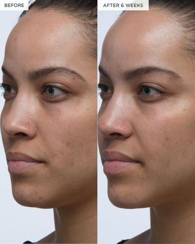 5 lọ serum Hàn giúp da căng bóng mướt mượt đón Tết sang: Nhiều loại giá mềm ai 'múc' cũng được - 13 5 lọ serum Hàn giúp da căng bóng mướt mượt đón Tết sang: Nhiều loại giá mềm ai 'múc' cũng được - 13